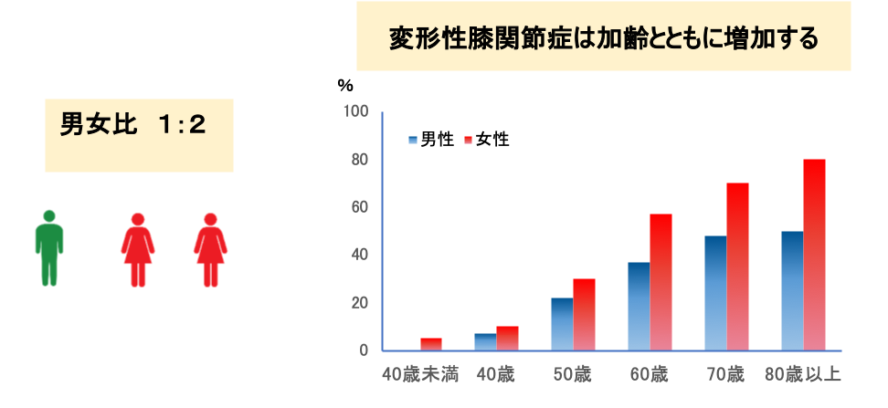 変形性膝関節症は加齢とともに増加する　グラフ