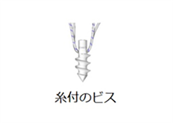 関節唇損傷